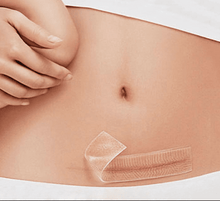 Load image into Gallery viewer, Gel Scar Therapy Patch