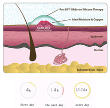Load image into Gallery viewer, Gel Scar Therapy Patch
